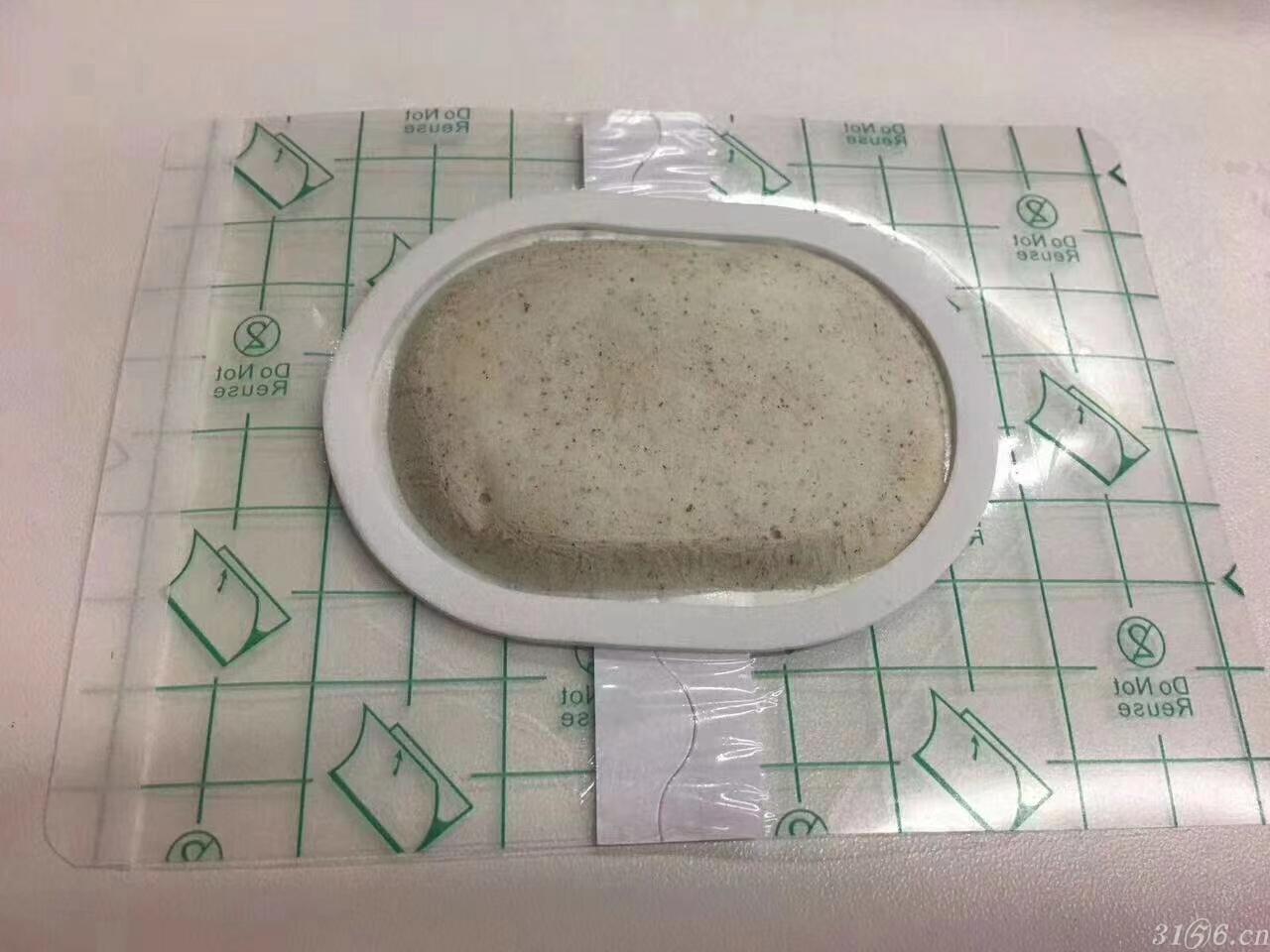 沙蒿子透皮贴厂家含药水二类器械